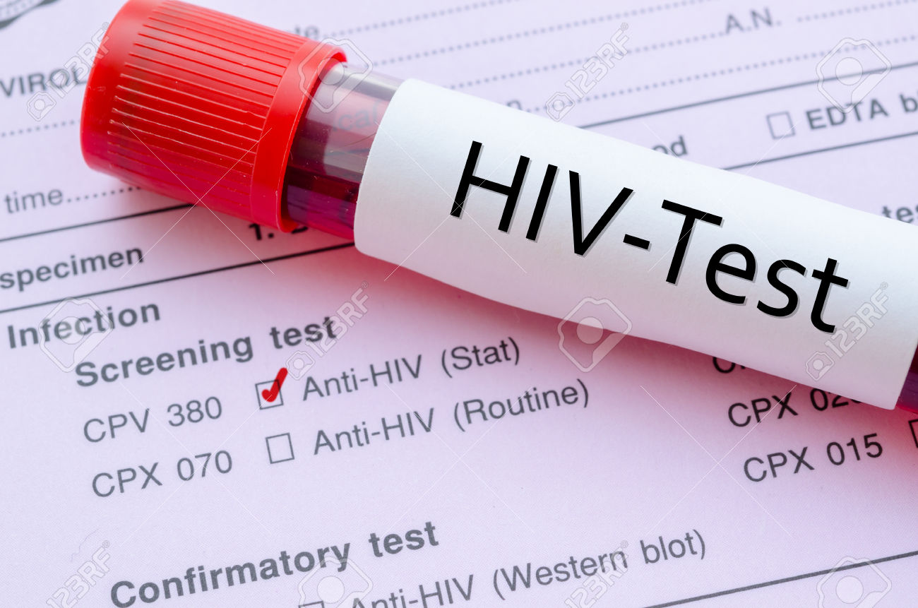 Crean mexicanos prueba de detección rápida de #VIH