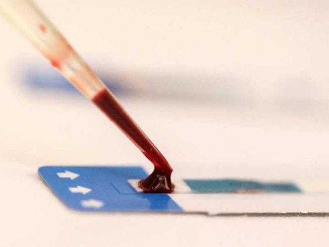 Se dispara epidemia de VIH en Europa: OMS