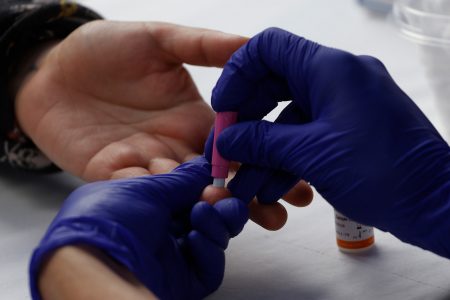 Adam Castillejo: una de las 3 personas en todo el mundo en recuperarse del VIH